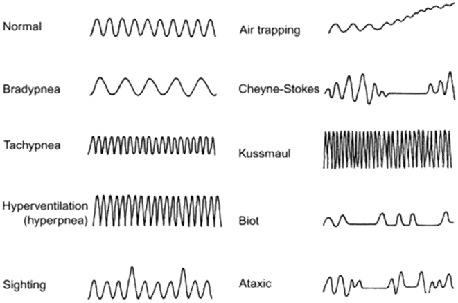 mmWave Technology, mmWave RADAR